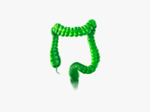 colorectal-cancer